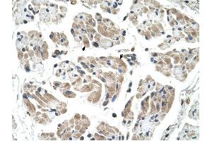 CHST1 antibody was used for immunohistochemistry at a concentration of 4-8 ug/ml to stain Skeletal muscle cells (arrows) in Human Muscle. (CHST1 抗体)