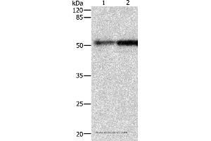 Western blot analysis of Human fetal kidney and lung tissue, using CASP2 Polyclonal Antibody at dilution of 1:950 (Caspase 2 抗体)