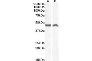 TACR1 抗体  (Internal Region)