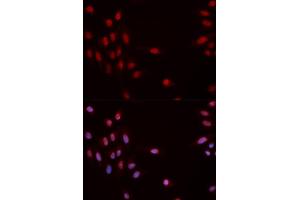 Immunofluorescence (IF) image for anti-Checkpoint Kinase 1 (CHEK1) (pSer317) antibody (ABIN1870071) (CHEK1 抗体  (pSer317))
