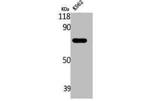 Western Blot analysis of K562 cells using ABCD4 Polyclonal Antibody