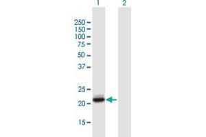 Western Blot analysis of LCN2 expression in transfected 293T cell line by LCN2 MaxPab polyclonal antibody. (Lipocalin 2 抗体  (AA 1-198))