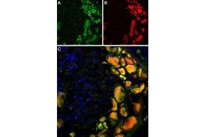 Multiplex staining of TRPV1 and mGluR5 in rat DRG - Immunohistochemical staining of rat dorsal root ganglion using Anti-Rat TRPV1 (VR1) (extracellular)-ATTO Fluor-488 Antibody (ABIN7043839), (1:60) and Anti-mGluR5 (extracellular)-ATTO Fluor-594 Antibody (ABIN7043251), (1:60). (Metabotropic Glutamate Receptor 5 抗体  (Extracellular, N-Term) (Atto 594))
