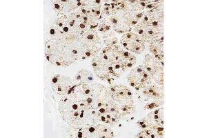 Immunohistochemical analysis of paraffin-embedded M. (HIST1H2AG 抗体  (AA 63-87))