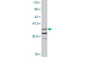 Western Blot detection against Immunogen (37. (Arx 抗体  (AA 159-264))