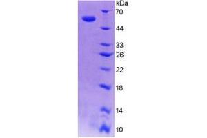 SDS-PAGE analysis of Human SPR Protein. (SPR 蛋白)
