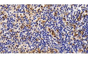 Detection of Bcl2L in Human Appendix Tissue using Monoclonal Antibody to B-Cell CLL/Lymphoma 2 Like Protein (Bcl2L) (BCL2L1 抗体  (AA 2-212))
