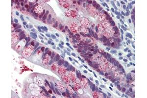 Immunohistochemistry (IHC) image for anti-Homeobox C8 (HOXC8) (N-Term) antibody (ABIN2781186)