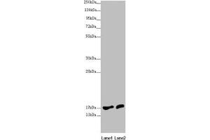 Western blot All lanes: NDUFA12 antibody at 3. (NDUFA12 抗体  (AA 1-145))