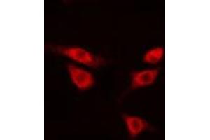 ABIN6275668 staining HepG2 cells by IF/ICC.