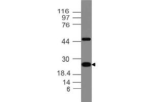 Image no. 1 for anti-Adiponectin (ADIPOQ) (AA 40-230) antibody (ABIN5027479) (ADIPOQ 抗体  (AA 40-230))