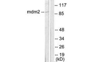 Western Blotting (WB) image for anti-Mdm2, p53 E3 Ubiquitin Protein Ligase Homolog (Mouse) (MDM2) (AA 391-440) antibody (ABIN2889224) (MDM2 抗体  (AA 391-440))