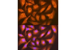 Immunofluorescence analysis of U-2 OS cells using F/UBD Rabbit mAb (ABIN7271134) at dilution of 1:100 (40x lens). (UBD 抗体)