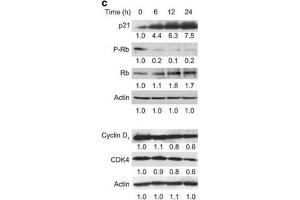Western Blotting (WB) image for anti-Cyclin-Dependent Kinase 4 (CDK4) antibody (ABIN2855529)