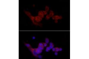 Immunofluorescence (IF) image for anti-Sterol Regulatory Element Binding Transcription Factor 1 (SREBF1) (AA 1-100) antibody (ABIN7270598)