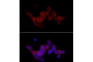 Immunofluorescence analysis of MCF7 cells using SREBF1 Rabbit pAb (ABIN7270598) at dilution of 1:100 (40x lens). (SREBF1 抗体  (AA 1-100))