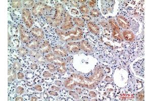 Immunohistochemistry (IHC) analysis of paraffin-embedded Human Kidney, antibody was diluted at 1:200. (DPP4 抗体)