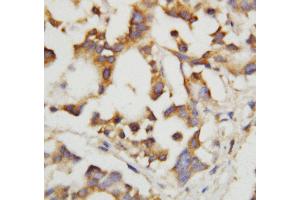 Anti-Cystathionase antibody, IHC(P) IHC(P): Human Liver Tissue (CTH 抗体  (C-Term))