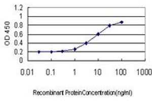 Detection limit for recombinant GST tagged SMC6L1 is approximately 0. (SMC6 抗体  (AA 1-110))