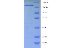 SDS-PAGE (SDS) image for Centrosomal Protein 63kDa (CEP63) (AA 1-495), (full length) protein (His-SUMO Tag) (ABIN5711585) (CEP63 Protein (AA 1-495, full length) (His-SUMO Tag))