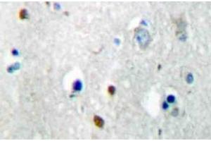 Immunohistochemistry (IHC) analyzes of MKP-2 antibody in paraffin-embedded human brain tissue. (DUSP4 抗体)