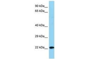 Image no. 1 for anti-NADH Dehydrogenase (Ubiquinone) 1 beta Subcomplex, 8, 19kDa (NDUFB8) (C-Term) antibody (ABIN6748144)