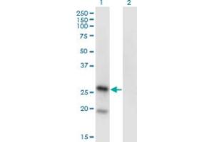 Western Blot analysis of KLRA1 expression in transfected 293T cell line by KLRA1 monoclonal antibody (M01), clone 1H3. (KLRA1 抗体  (AA 66-171))