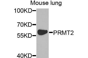 Western blot analysis of extracts of mouse lung cells, using PRMT2 antibody. (PRMT2 抗体)