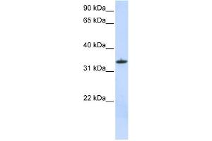 WB Suggested Anti-MRPL15 Antibody Titration:  0. (MRPL15 抗体  (C-Term))