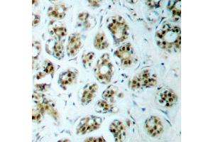 Immunohistochemistry (IHC) image for anti-Nuclear Factor-kB p65 (NFkBP65) (pSer311) antibody (ABIN1870583) (NF-kB p65 抗体  (pSer311))