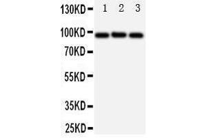 Western Blotting (WB) image for anti-ATP-Binding Cassette, Sub-Family B (MDR/TAP), Member 6 (ABCB6) (AA 818-842), (C-Term) antibody (ABIN3044283) (ABCB6 抗体  (C-Term))