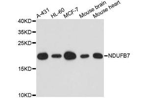 Western blot analysis of extracts of various cell lines, using NDUFB7 antibody. (NDUFB7 抗体  (AA 1-137))