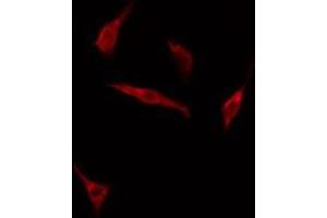 ABIN6275159 staining HuvEc cells by IF/ICC. (GRB14 抗体  (Internal Region))