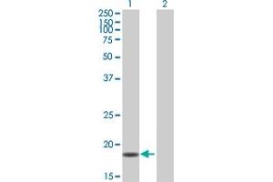 Western Blot analysis of PPIL3 expression in transfected 293T cell line by PPIL3 MaxPab polyclonal antibody. (PPIL3 抗体  (AA 1-161))