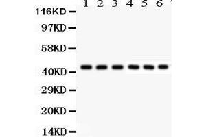 Western Blotting (WB) image for anti-KIN, Antigenic Determinant of RecA Protein Homolog (KIN) (AA 3-202) antibody (ABIN3042474) (KIN 抗体  (AA 3-202))