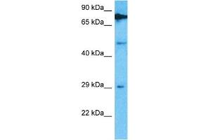 Host:  Rabbit  Target Name:  TRMT61B  Sample Type:  Hela Whole Cell lysates  Antibody Dilution:  1. (TRMT61B 抗体  (C-Term))