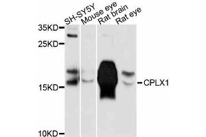 Western blot analysis of extracts of various cell lines, using CPLX1 antibody (ABIN5997502) at 1:3000 dilution. (Complexin 1 抗体)