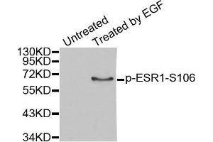 Western blot analysis of extracts from MCF7 cells, using Phospho-ESR1-S106 antibody. (Estrogen Receptor alpha 抗体  (pSer106))