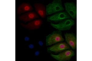 ABIN6258930 and ABIN6275667 staining Hela cells by IF/ICC. (UGDH 抗体  (C-Term))