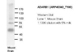 Image no. 2 for anti-Adenosine Deaminase, RNA-Specific, B1 (ADARB1) (N-Term) antibody (ABIN2778757) (RED1 抗体  (N-Term))