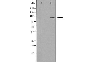 Western blot analysis of extracts from HUVEC cells, using RBM5 antibody. (RBM5 抗体  (N-Term))