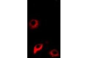 Immunofluorescent analysis of NNMT staining in Hela cells. (NNMT 抗体)