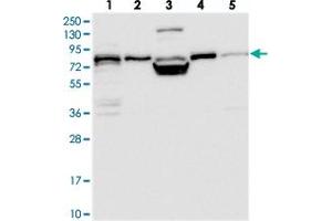 Western blot analysis of Lane 1: RT-4, Lane 2: U-251 MG, Lane 3: Human Plasma, Lane 4: Liver, Lane 5: Tonsil with PEX5 polyclonal antibody  at 1:250-1:500 dilution. (PEX5 抗体)