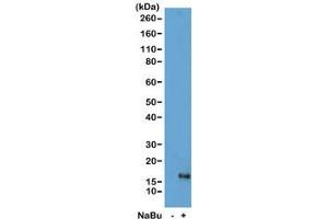 Western blot of acid extracts from HeLa cells untreated (-) or treated (+) with sodium butyrate using recombinant H3K79ac antibody at 1 ug/ml showed a band of Histone H3 acetylated at Lysine 79 in treated HeLa cells. (Recombinant Histone 3 抗体  (acLys79))