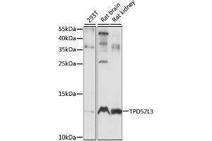 Western blot analysis of extracts of various cell lines, using TPD52L3 antibody. (TPD52L3 抗体)