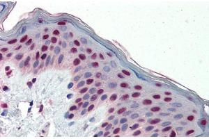 Immunohistochemistry with Human Skin lysate tissue at an antibody concentration of 5. (FOSL1 抗体  (Middle Region))