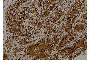 ABIN6275528 at 1/100 staining Human kidney tissue by IHC-P. (STK32C 抗体  (Internal Region))