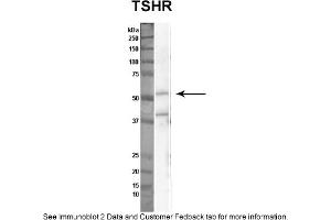 Sample Type: Nthy-ori cell lysate (50ug)Primary Dilution: 1:1000Secondary Antibody: anti-rabbit HRPSecondary Dilution: 1:2000Image Submitted By: Anonymous (TSH receptor 抗体  (N-Term))