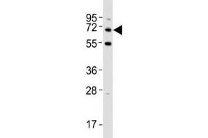 Western Blotting (WB) image for anti-Sequestosome 1 (SQSTM1) (AA 317-346) antibody (ABIN3031543)
