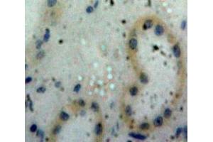 Used in DAB staining on fromalin fixed paraffin-embedded Kidney tissue (PPIA 抗体  (AA 2-164))